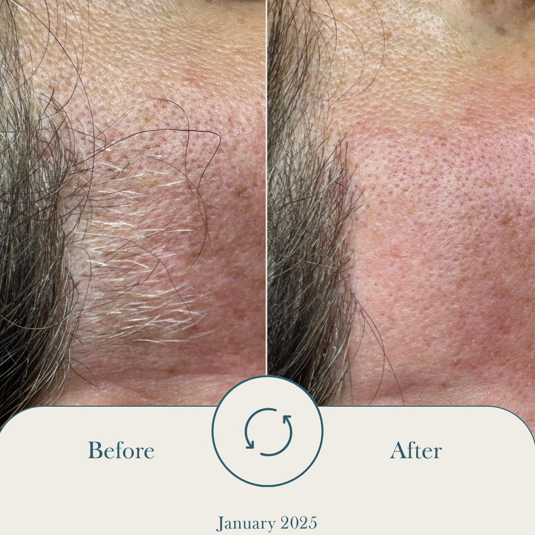 Electrolysis Sept 25