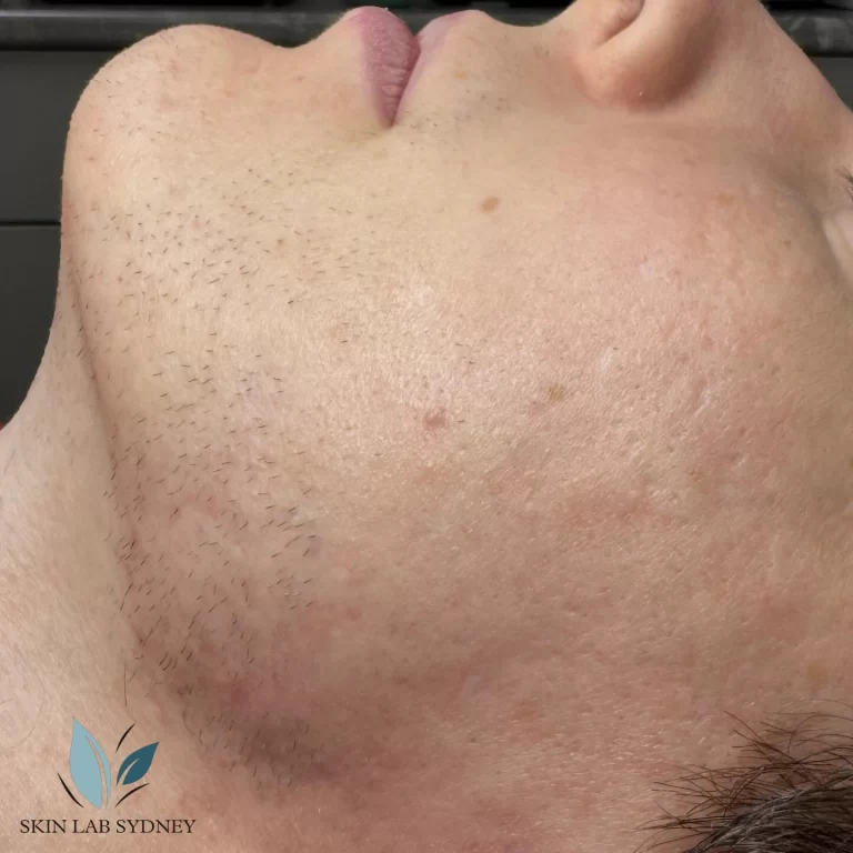 Instagram post from skinlabsydney. This post is in position 0.