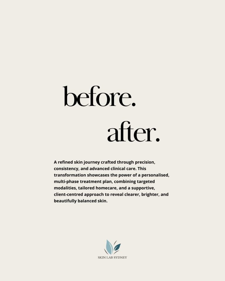 Instagram post from skinlabsydney. This post is in position 2.