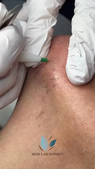 Instagram post from skinlabsydney. This post is in position 2.