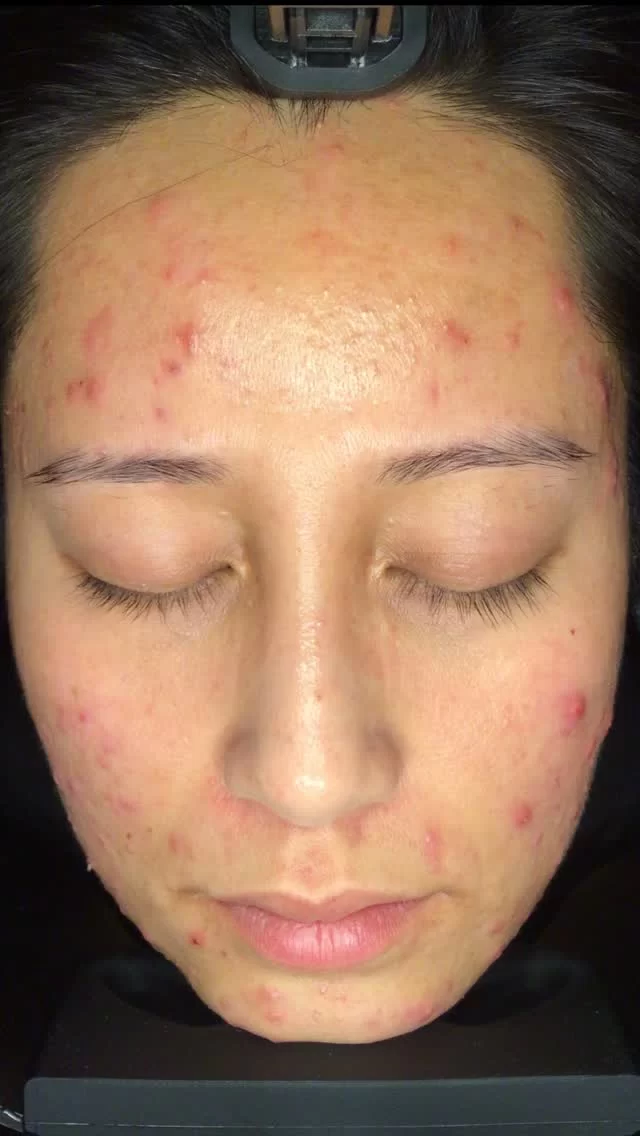 Instagram post from skinlabsydney. This post is in position 0.