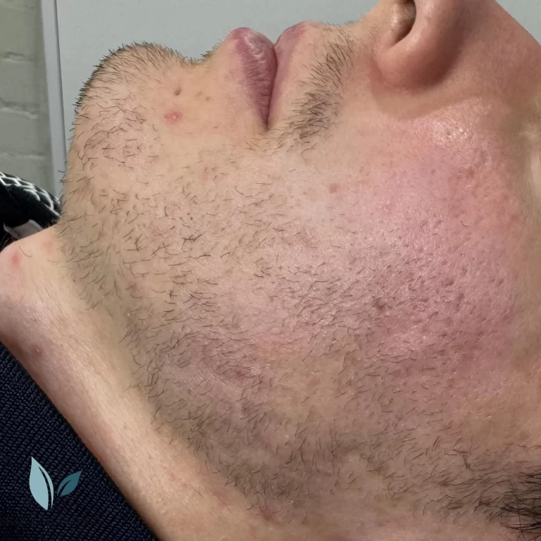 Instagram post from skinlabsydney. This post is in position 1.