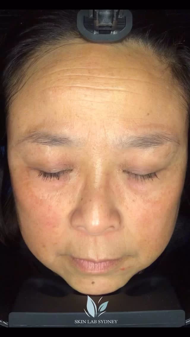 Instagram post from skinlabsydney. This post is in position 0.