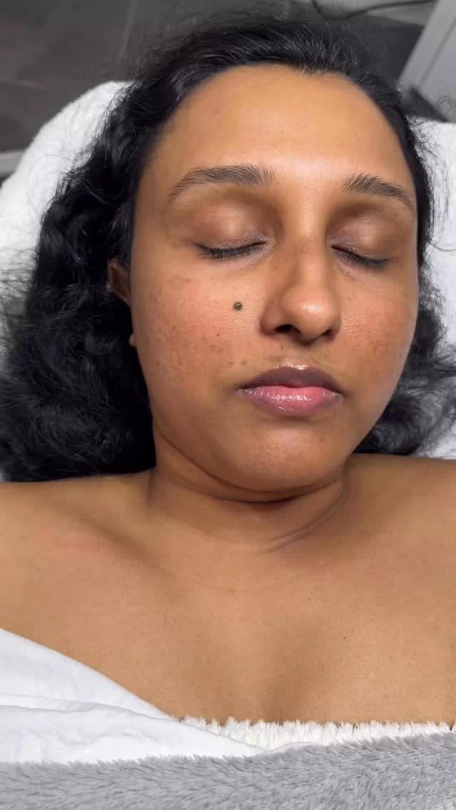 Instagram post from skinlabsydney. This post is in position 4.