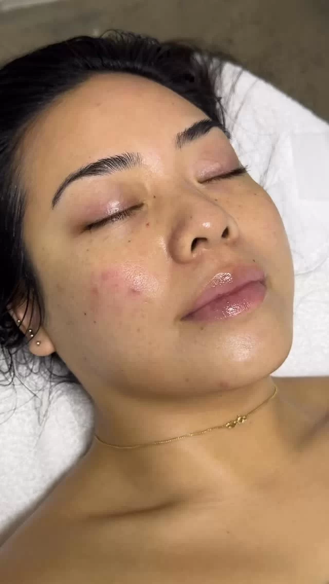Instagram post from skinlabsydney. This post is in position 2.